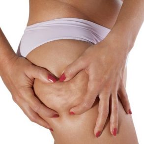 adiosalacelulitis_marketingdecontenidosespaña_blogprofesional_mivestidoazul.com_blogdemodaenespañol0